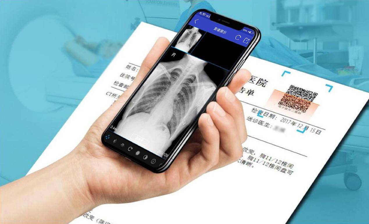 云膠片是什么？